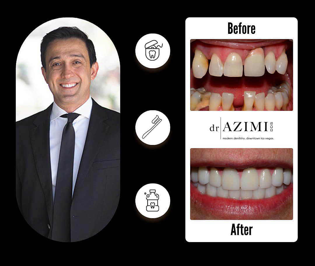 Dr. Azimi Dental Implants Layout